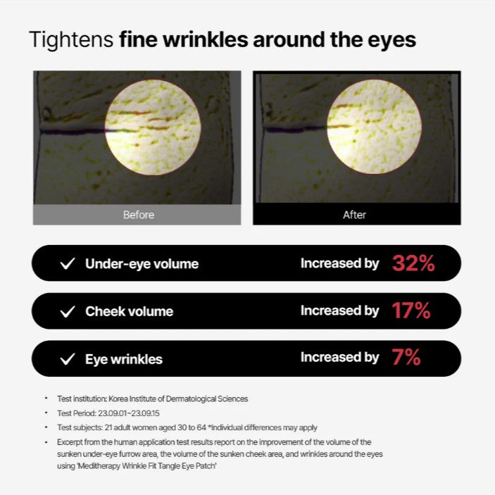 MEDITHERAPY Wrinkle-Fit Tangle Eye Patch 4ea